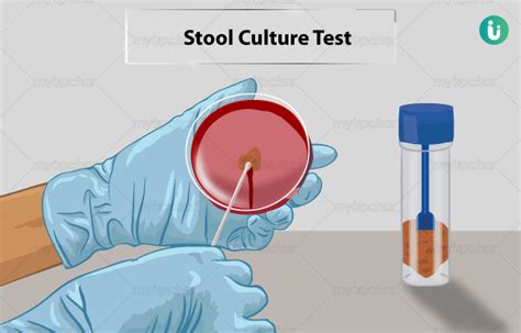 Stool Sample Culture Test: Purpose, Procedure, Duration, .